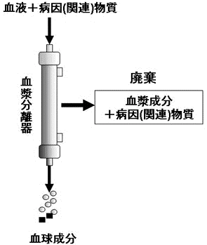 単純血漿交換法