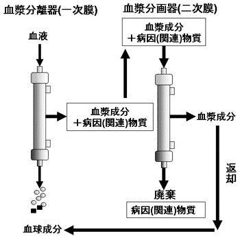 二重膜濾過血漿交換法