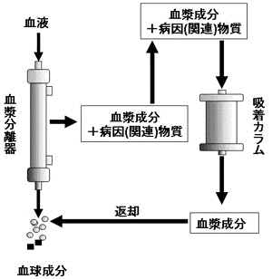 血漿潅流法